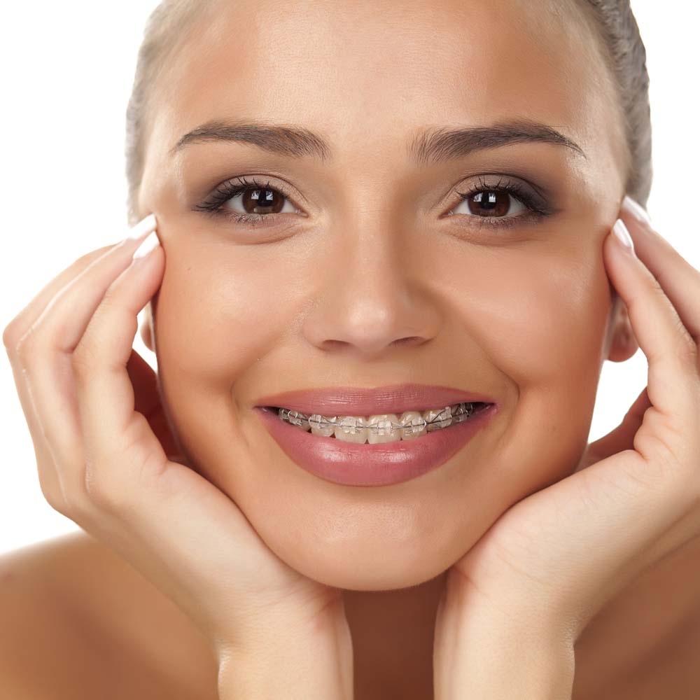 smile design orthodontics houston tx services clear braces
